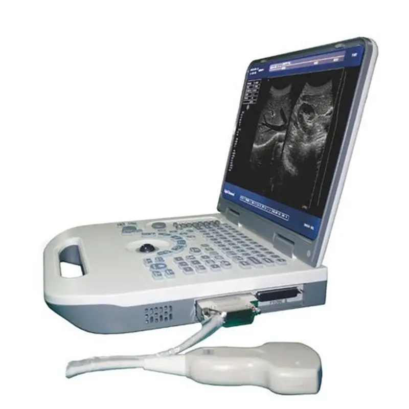 used Nyro 10 ultrasound